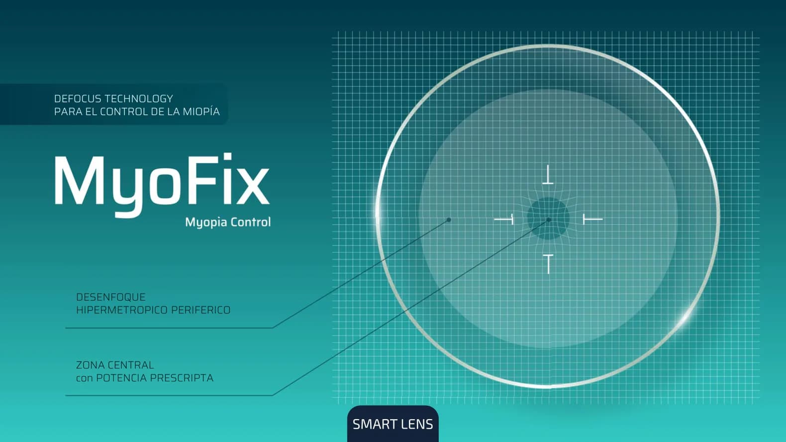 Esquema del cristal MyoFix con Defocus Technology: zona central con la potencia prescripta y desenfoque hipermetrópico periférico alrededor.