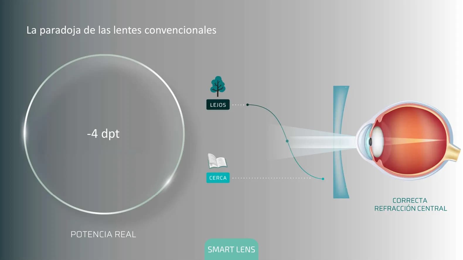 La paradoja de las lentes convencionales: en el centro la potencia real, -4 dioptrías, es la correcta.